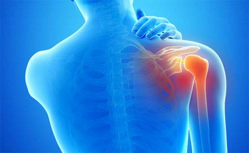 肩周炎怎么预防注意什么呢